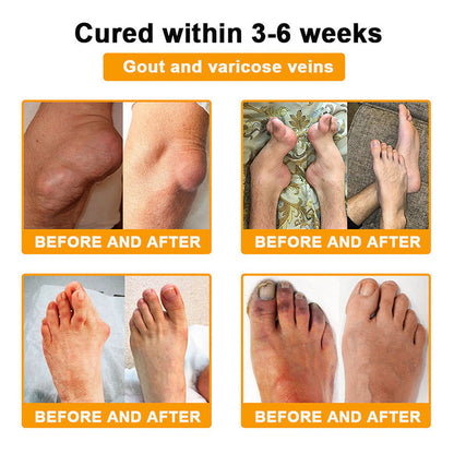 Official Only Store Healrize®🔥 BEE VENOM LITHOSPERMUM Pain-Relief Bone Healing Cream 👑👑(Specially for older adults)