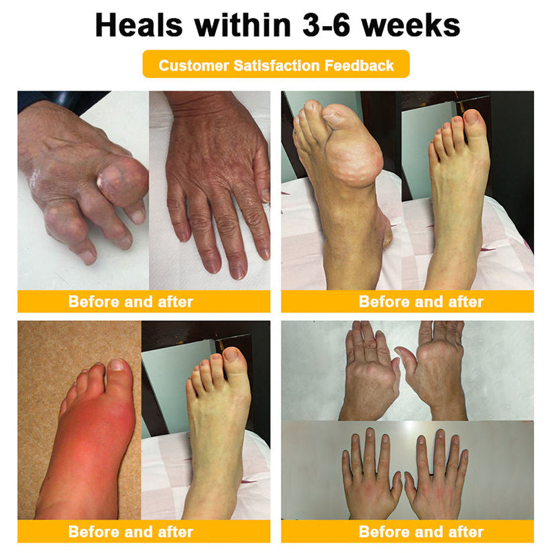 Official Only Store Healrize®🔥 BEE VENOM LITHOSPERMUM Pain-Relief Bone Healing Cream 👑👑(Specially for older adults)
