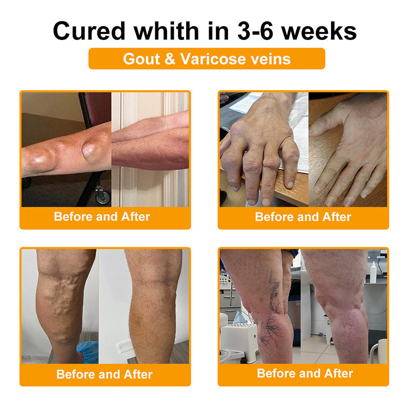 Official Only Store Healrize®🔥 BEE VENOM LITHOSPERMUM Pain-Relief Bone Healing Cream 👑👑(Specially for older adults)