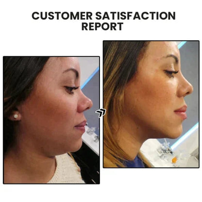 🔥𝐂𝐙𝐓𝐈𝐂𝐋𝐄® Lymphvity MagneTherapy Germanium Earrings💎 (Worn once a day, visible changes in 7 days) Support for obesity, diabetes, sleep apnea and joint problems 🍃