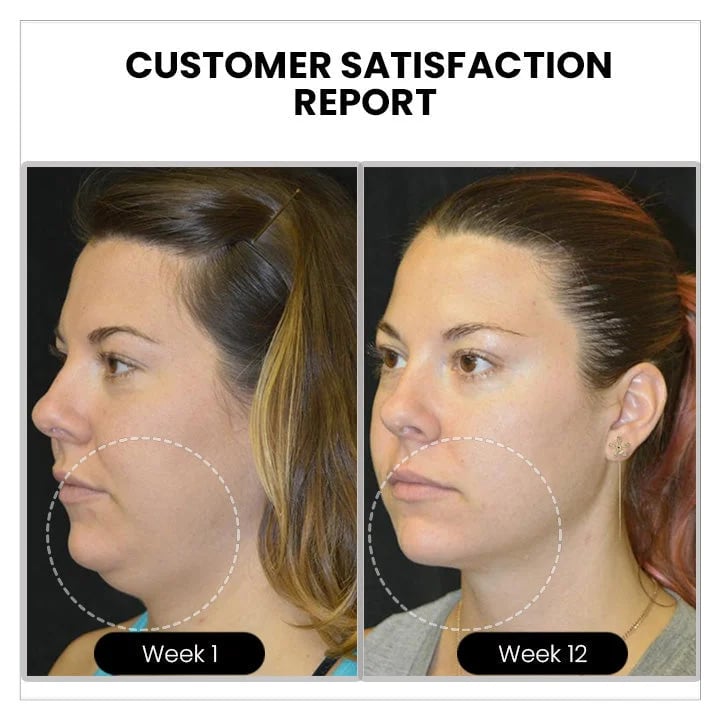 🔥𝐂𝐙𝐓𝐈𝐂𝐋𝐄® Lymphvity MagneTherapy Germanium Earrings💎 (Worn once a day, visible changes in 7 days) Support for obesity, diabetes, sleep apnea and joint problems 🍃