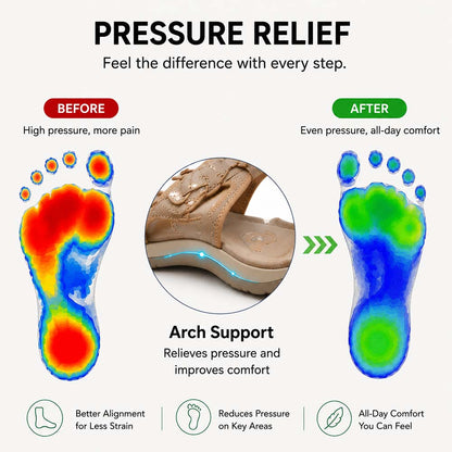 LAST DAY SALE-80% OFF 🏆 2026 Best Seller – Women’s Most Wanted Soft Arch Support & Adjustable Sandals ☁️💆‍♀️